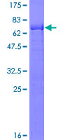 ab160678 on a 12.5% SDS-PAGE stained with Coomassie Blue.