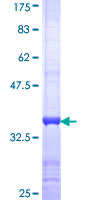ab159251 on a 12.5% SDS-PAGE stained with Coomassie Blue.
