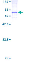 ab159253 on a 12.5% SDS-PAGE stained with Coomassie Blue.