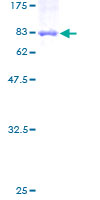 ab159254 on a 12.5% SDS-PAGE stained with Coomassie Blue.