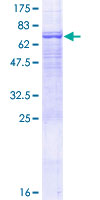 ab159255 on a 12.5% SDS-PAGE stained with Coomassie Blue.