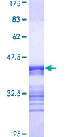 ab159257 on a 12.5% SDS-PAGE stained with Coomassie Blue.