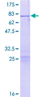 ab159258 on a 12.5% SDS-PAGE stained with Coomassie Blue.
