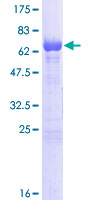 ab159269 on a 12.5% SDS-PAGE stained with Coomassie Blue.