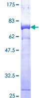 ab159272 on a 12.5% SDS-PAGE stained with Coomassie Blue.