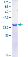ab160883 on a 12.5% SDS-PAGE stained with Coomassie Blue.