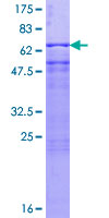 ab160685 on a 12.5% SDS-PAGE stained with Coomassie Blue.