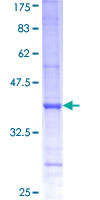 ab160686 on a 12.5% SDS-PAGE stained with Coomassie Blue.