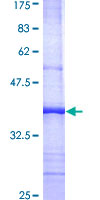 ab159268 on a 12.5% SDS-PAGE stained with Coomassie Blue.