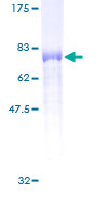 ab160311 on a 12.5% SDS-PAGE stained with Coomassie Blue.