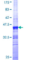 ab160312 on a 12.5% SDS-PAGE stained with Coomassie Blue.