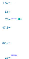 ab160310 on a 12.5% SDS-PAGE stained with Coomassie Blue.