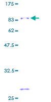 ab163666 on a 12.5% SDS-PAGE stained with Coomassie Blue.