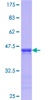ab163667 on a 12.5% SDS-PAGE stained with Coomassie Blue.