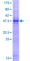 ab162430 on a 12.5% SDS-PAGE stained with Coomassie Blue.