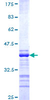 ab162431 on a 12.5% SDS-PAGE stained with Coomassie Blue.