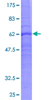 ab159274 on a 12.5% SDS-PAGE stained with Coomassie Blue.