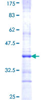 ab159275 on a 12.5% SDS-PAGE stained with Coomassie Blue.