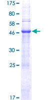 ab162697 on a 12.5% SDS-PAGE stained with Coomassie Blue.