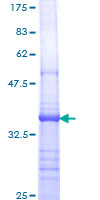 ab159287 on a 12.5% SDS-PAGE stained with Coomassie Blue.