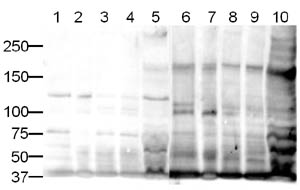 Exposure time : 10 minutes Lanes 1 to 10: ab12550 Rabbit polyclonal to PTPD1 (1/500) . Predicted band observed (~179kDa) in lanes 1-5 but not in lanes treated with ab12560 (blocking peptide). Lanes 1 to 10: 20µg of cell lysate per lane. Lanes 6 to 10: ab12550 + 1µg/ml blocking peptide (ab12560) Lane 1: HeLa Nuclear Extract Lane 2: HeLa Whole Cell Lysate Lane 3: A431 Whole Cell Lysate Lane 4: Jurkat Whole Cell Lysate Lane 5: HEK293 Whole Cell Lysate Lane 6: HeLa Nuclear Extract + blocking peptide (ab12560) Lane 7: HeLa Whole Cell Lysate + blocking peptide (ab12560) Lane 8: A431 Whole Cell Lysate + blocking peptide (ab12560) Lane 9: Jurkat Whole Cell Lysate + blocking peptide (ab12560) Lane 10: HEK293 Whole Cell Lysate + blocking peptide (ab12560)