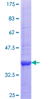 ab161921 on a 12.5% SDS-PAGE stained with Coomassie Blue.