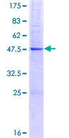 ab165303 on a 12.5% SDS-PAGE stained with Coomassie Blue.