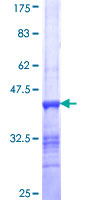 ab159288 on a 12.5% SDS-PAGE stained with Coomassie Blue.