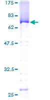 ab164258 on a 12.5% SDS-PAGE stained with Coomassie Blue.
