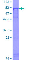 ab164404 on a 12.5% SDS-PAGE stained with Coomassie Blue.