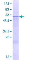 ab165261 on a 12.5% SDS-PAGE stained with Coomassie Blue.