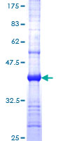 ab159289 on a 12.5% SDS-PAGE stained with Coomassie Blue.