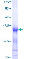 ab164348 on a 12.5% SDS-PAGE stained with Coomassie Blue.
