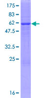 ab162262 on a 12.5% SDS-PAGE stained with Coomassie Blue.