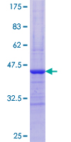 ab159294 on a 12.5% SDS-PAGE stained with Coomassie Blue.