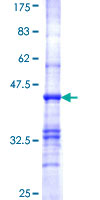 ab152601 on a 12.5% SDS-PAGE stained with Coomassie Blue.