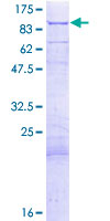 ab158286 on a 12.5% SDS-PAGE stained with Coomassie Blue.