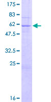 ab162845 on a 12.5% SDS-PAGE stained with Coomassie Blue.