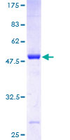 ab161748 on a 12.5% SDS-PAGE stained with Coomassie Blue.