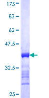 ab161749 on a 12.5% SDS-PAGE stained with Coomassie Blue.