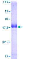 ab162824 on a 12.5% SDS-PAGE stained with Coomassie Blue.