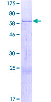 ab159295 on a 12.5% SDS-PAGE stained with Coomassie Blue.