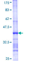 ab165128 on a 12.5% SDS-PAGE stained with Coomassie Blue.