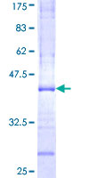 ab165492 on a 12.5% SDS-PAGE stained with Coomassie Blue.