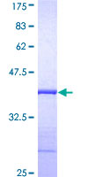 ab153304 on a 12.5% SDS-PAGE stained with Coomassie Blue.
