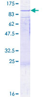 ab159301 on a 12.5% SDS-PAGE stained with Coomassie Blue.