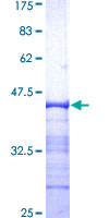 ab159302 on a 12.5% SDS-PAGE stained with Coomassie Blue.