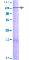 ab166383 on a 12.5% SDS-PAGE stained with Coomassie Blue.