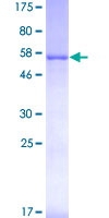 ab159305 on a 12.5% SDS-PAGE stained with Coomassie Blue.
