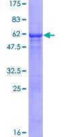 ab165514 on a 12.5% SDS-PAGE stained with Coomassie Blue.